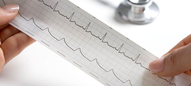 EKG'den Hayatı Okumak