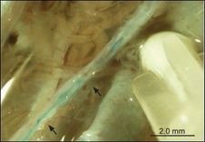 Akupunkturun Bilimsel Yanı mı Varmış?